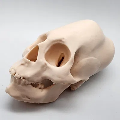 Hộp Sọ Người Peru Nữ Bị Bó Chặt