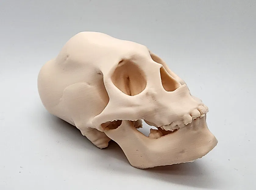 Hộp Sọ Người Peru Nữ Bị Bó Chặt - Image 5