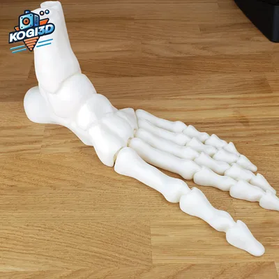 Bàn Chân Bộ Xương Khớp Toàn Diện In-Place