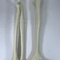 Xương Cánh Tay Trái - Thumbnail 1