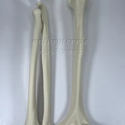 Xương Cánh Tay Trái