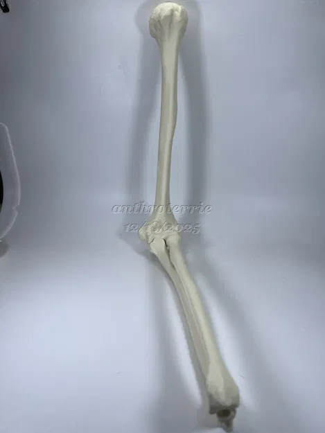 Xương Cánh Tay Trái - Image 2