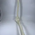 Xương Cánh Tay Trái - Thumbnail 2