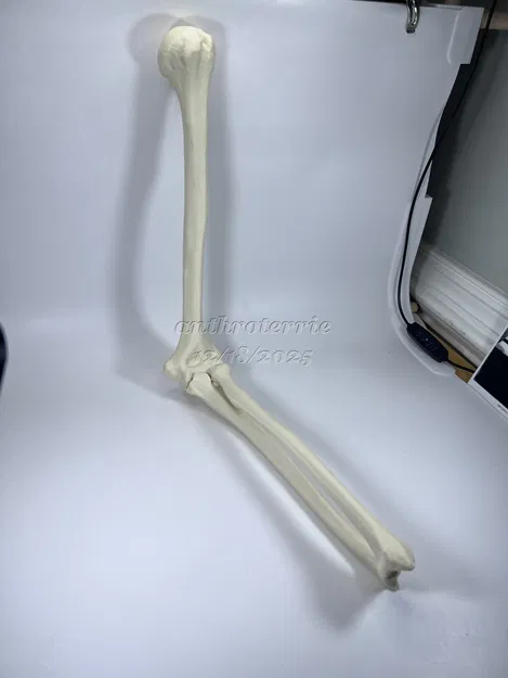 Xương Cánh Tay Trái - Image 3