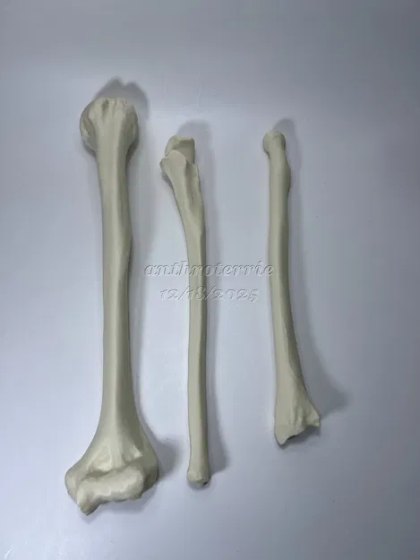 Xương Cánh Tay Trái - Image 4