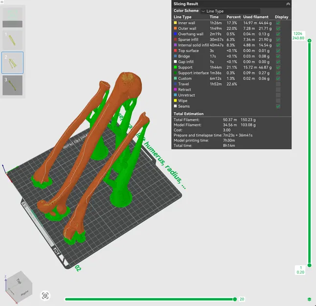Xương Cánh Tay Trái - Image 5