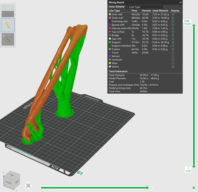 Xương Cánh Tay Trái - Image 6