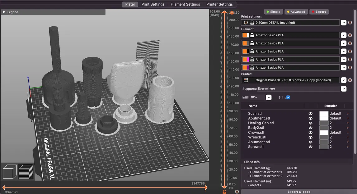 Mô hình ví dụ Implant Nha khoa Cỡ lớn với Nhiều Bộ phận - Image 2