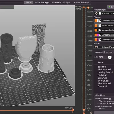 Mô hình ví dụ Implant Nha khoa Cỡ lớn với Nhiều Bộ phận