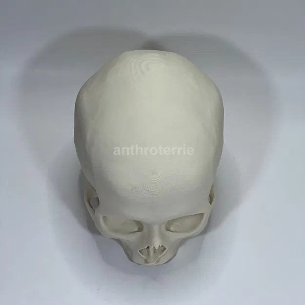 Hộp Sọ và Hàm Dưới Nữ Giới Nhìn Thấy - Image 7