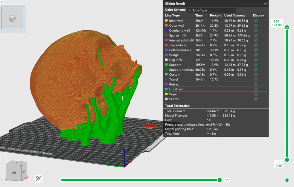 Hộp Sọ và Hàm Dưới Nữ Giới Nhìn Thấy - Image 10