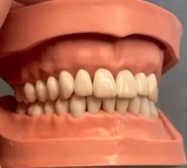 Mô hình răng giả người chân thật - Image 1