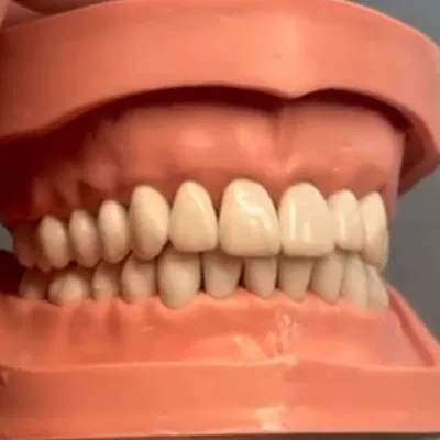 Mô hình răng giả người chân thật