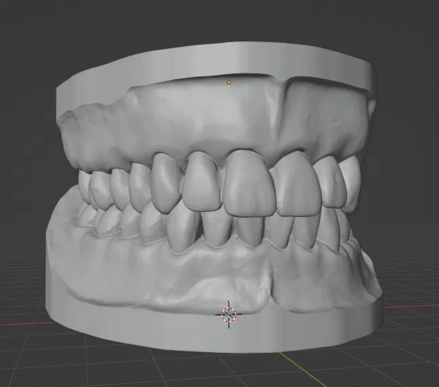 Mô hình răng giả người chân thật - Image 2