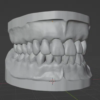 Mô hình răng giả người chân thật