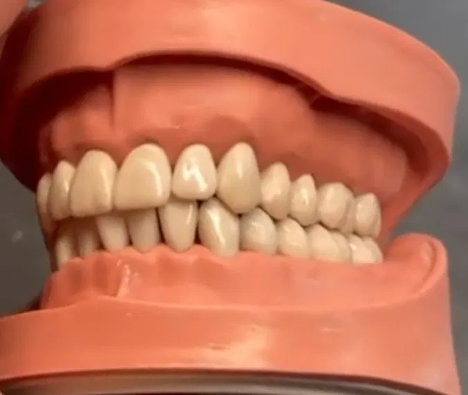 Mô hình răng giả người chân thật - Image 3