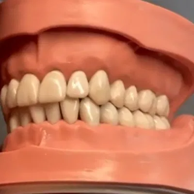 Mô hình răng giả người chân thật