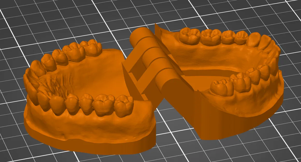 Mô hình răng giả thực tế có bản lề in cùng lúc - Image 1