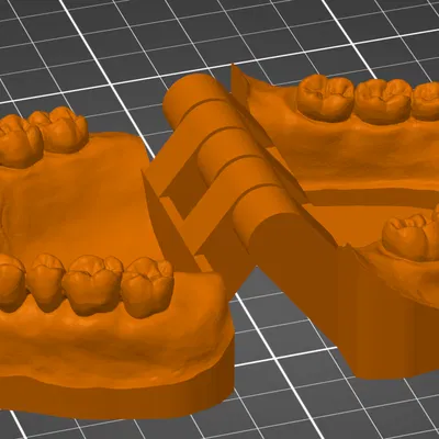 Mô hình răng giả thực tế có bản lề in cùng lúc