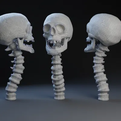 Đầu Lâu và Cột Sống Toff / Chóp Gậy