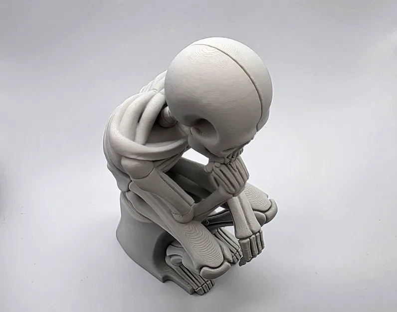 Tượng Bộ Xương Đang Suy Tư - Image 13