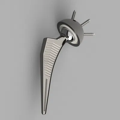 Giải mã chỉnh hình: Mô Hình Thay Khớp Háng Toàn Bộ