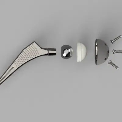 Giải mã chỉnh hình: Mô Hình Thay Khớp Háng Toàn Bộ