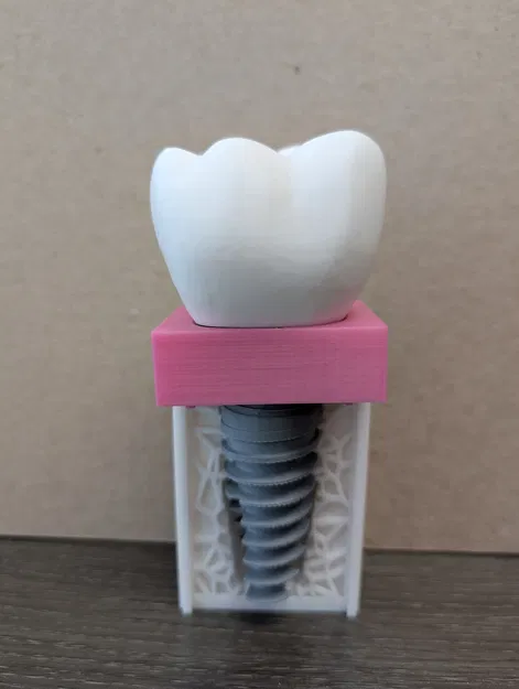 Mô Hình Giáo Dục Bệnh Nhân Cấy Ghép Keon / Giải Trí Cho Nha Sĩ - Image 1