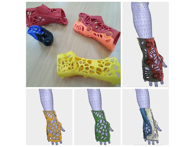 Nẹp Tay Ferula Mano - Image 1