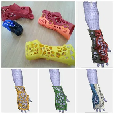 Nẹp Tay Ferula Mano