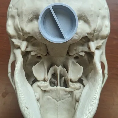 Heo Đất Hình Đầu Lâu Người, Chuẩn Giải Phẫu