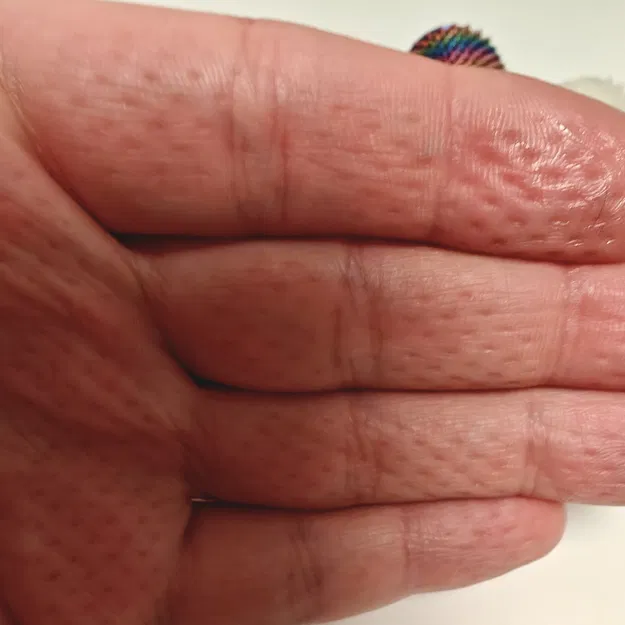 Little Ouchy – Đồ chơi stim an toàn để bấm/gai nhẹ - Image 4