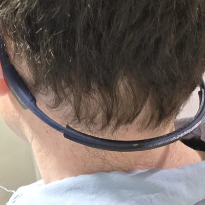 Kẹp siết tai nghe Shokz cho người đầu nhỏ (athlete)