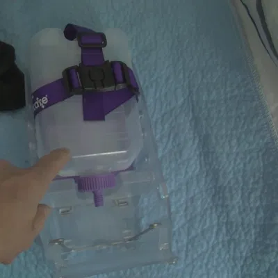 Vòng chêm chai PEG (Giving Set) – phương pháp đeo backpack