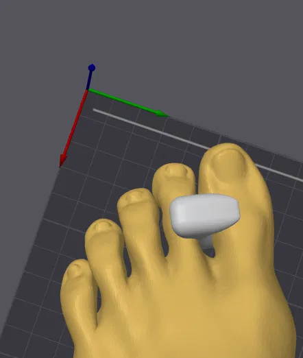 Bunion Corrector – Dụng cụ nắn chỉnh bunion (ngón chân cái lệch) - Image 2