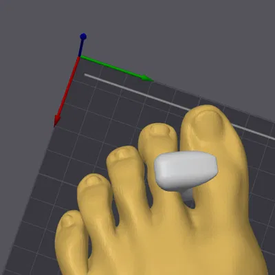 Bunion Corrector – Dụng cụ nắn chỉnh bunion (ngón chân cái lệch)