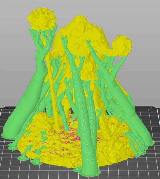 Bloodbound Realms – Elf – Verdant Druid of the Veiled Grove (STL miniature) - Image 6