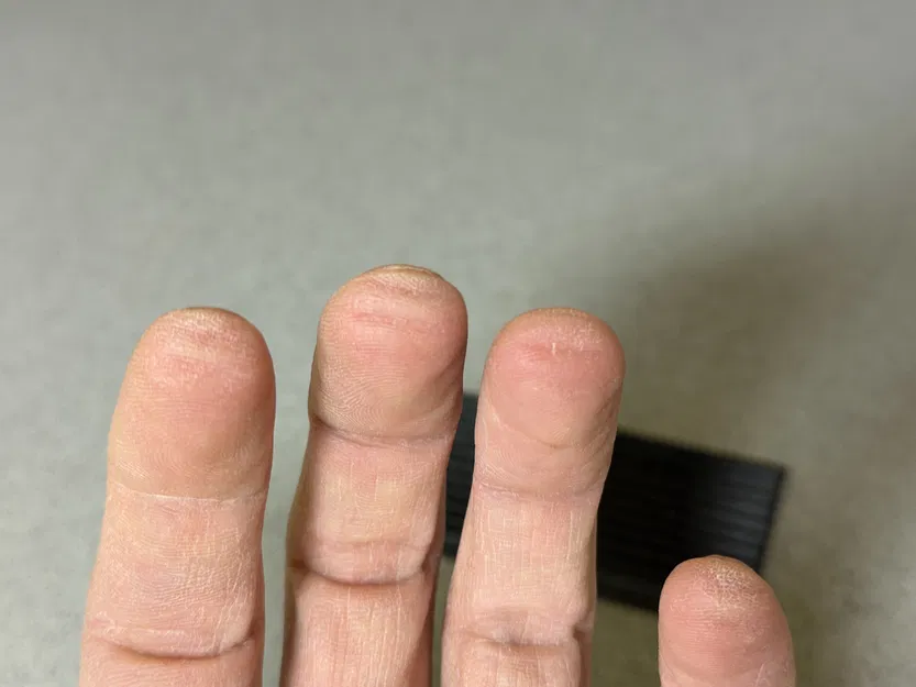 Dụng cụ luyện chai đầu ngón tay (Finger Callus Trainer) - Image 3