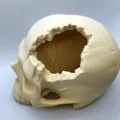 Hộp Sọ “Major Headache Skull” - Thumbnail 2