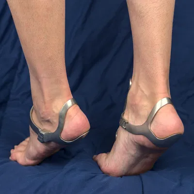 Ankle Cage V2 – Khung khóa mắt cá bắt buộc đứng nhón mũi