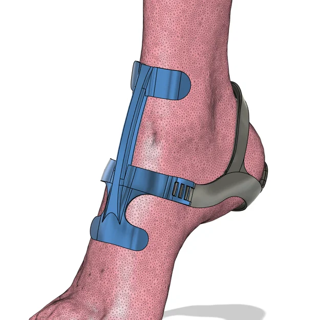 Ankle Cage V2 – Khung khóa mắt cá bắt buộc đứng nhón mũi - Image 4