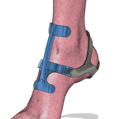 Ankle Cage V2 – Khung khóa mắt cá bắt buộc đứng nhón mũi