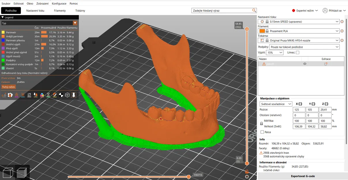 Mô Hình Quai Hàm Người 3D Giải Phẫu Tỉ Lệ 1:1 Từ CT Scan - Image 1