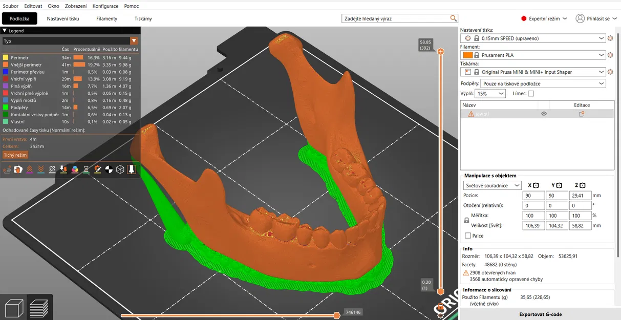 Mô Hình Quai Hàm Người 3D Giải Phẫu Tỉ Lệ 1:1 Từ CT Scan - Image 2