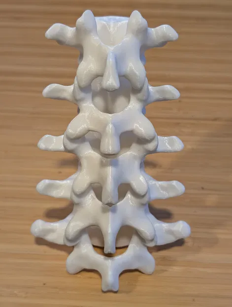 Đốt sống thắt lưng (Lumbar vertebrae) - Image 1