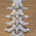 Đốt sống thắt lưng (Lumbar vertebrae) - Thumbnail 1