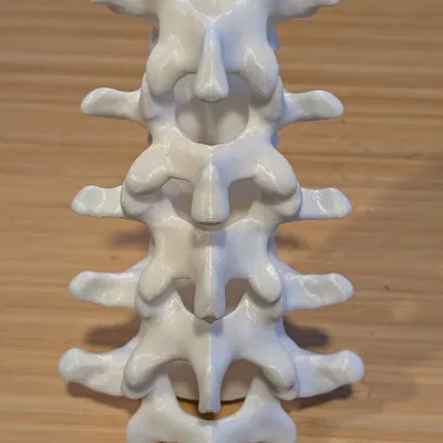Đốt sống thắt lưng (Lumbar vertebrae)