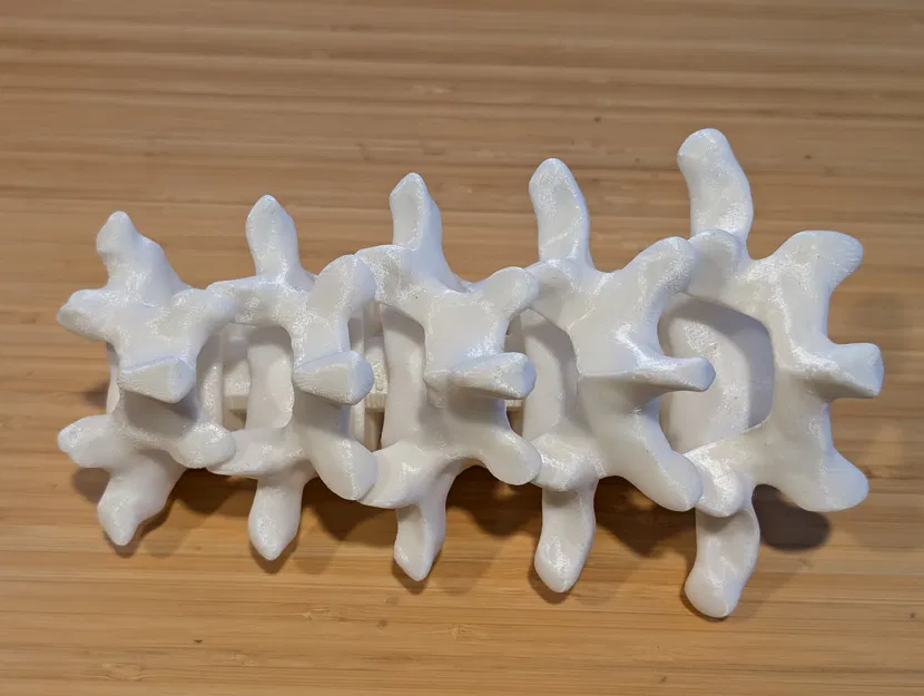 Đốt sống thắt lưng (Lumbar vertebrae) - Image 2