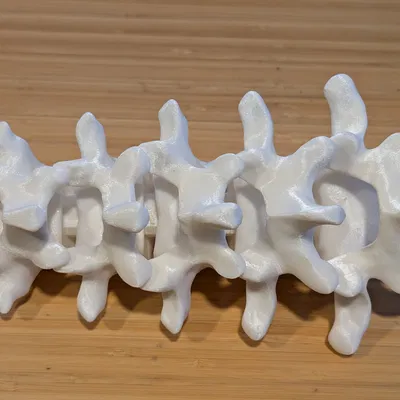 Đốt sống thắt lưng (Lumbar vertebrae)