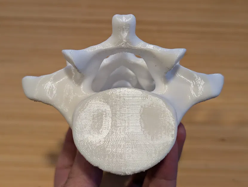 Đốt sống thắt lưng (Lumbar vertebrae) - Image 3